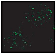 VPS35 | Vacuolar protein sorting-associated protein 35B (marker of PVC) in the group Antibodies Plant/Algal / Membrane Transport System / Vacuolar membrane at Agrisera AB (Antibodies for research) (AS20 4402)